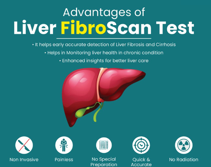Fibroscan Procedure in Noida